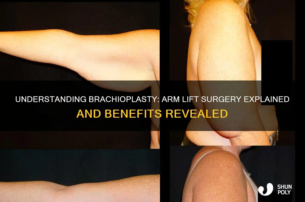 what is brachioplasty plastic surgery
