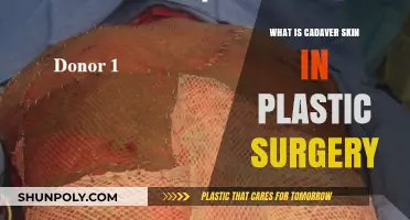 Understanding Cadaver Skin's Role in Plastic Surgery Procedures