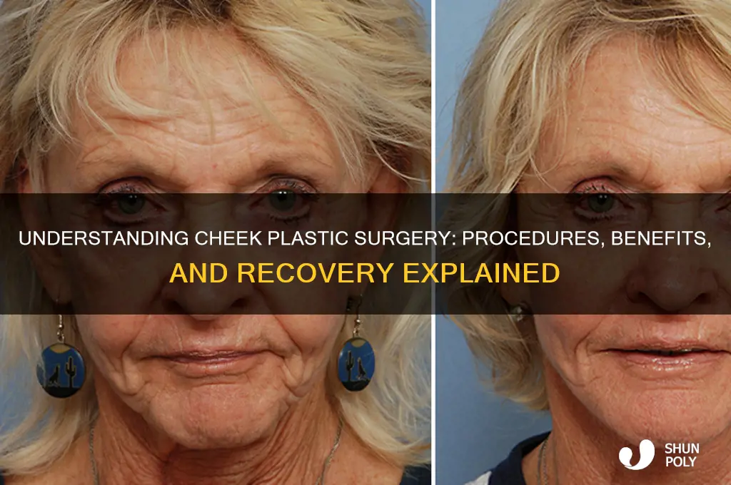 what is cheek plastic surgery