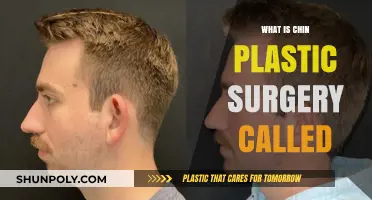 Understanding Mentoplasty: The Surgical Procedure for Chin Enhancement Explained