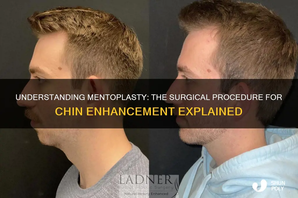 what is chin plastic surgery called