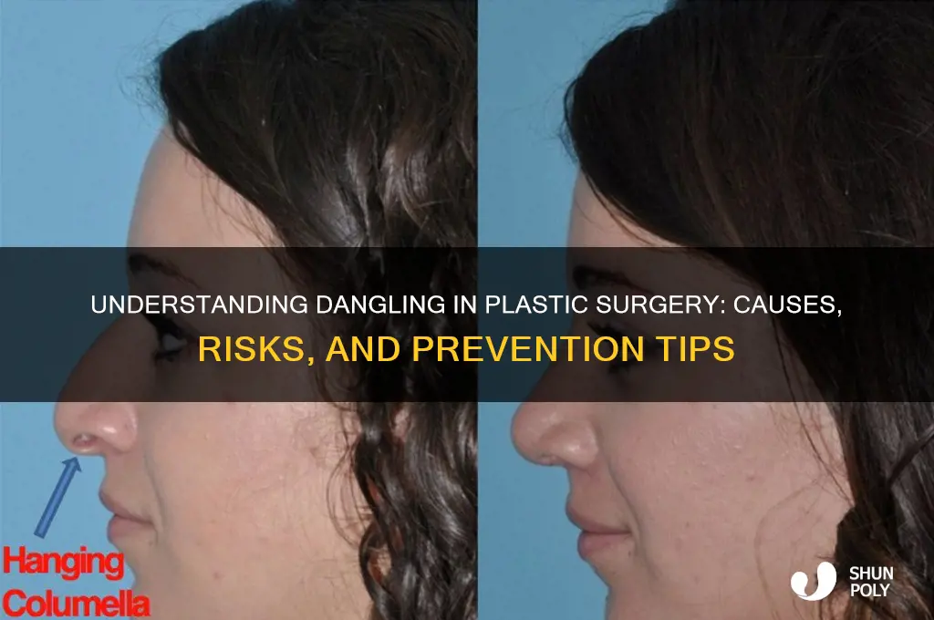 what is dangling in plastic surgery