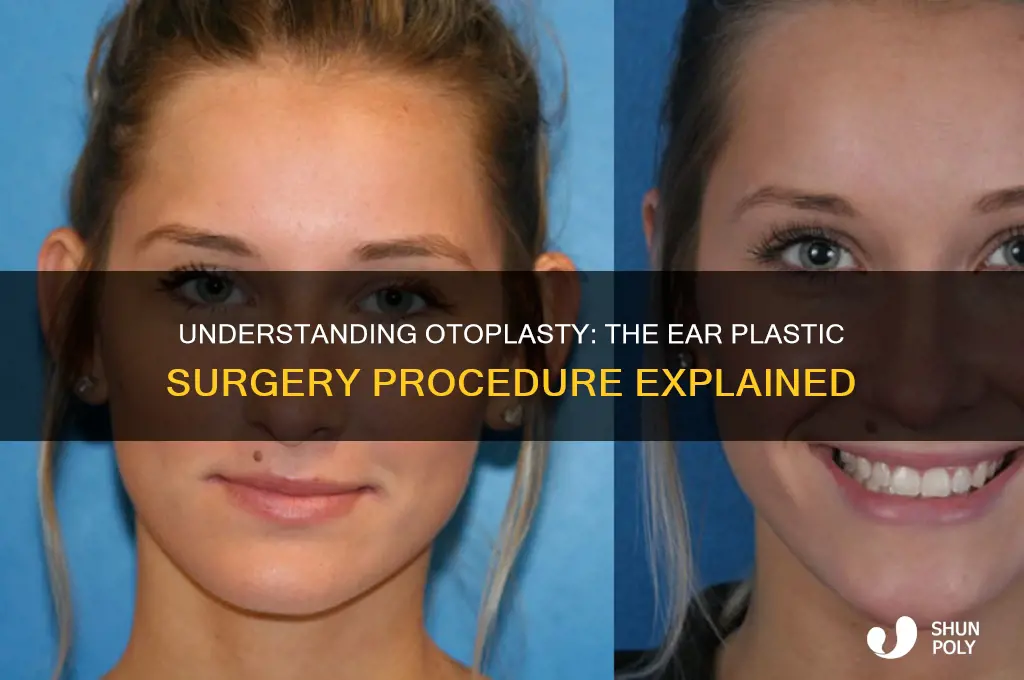 what is ear plastic surgery called