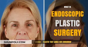 Endoscopic Plastic Surgery: Minimally Invasive Techniques for Enhanced Results