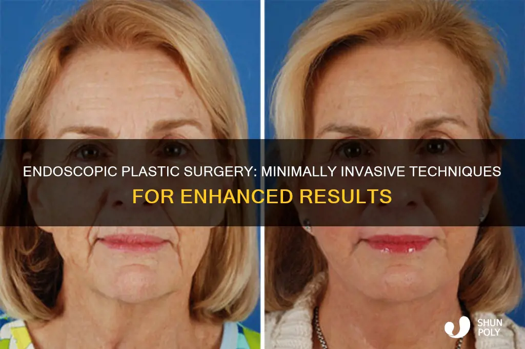 what is endoscopic plastic surgery