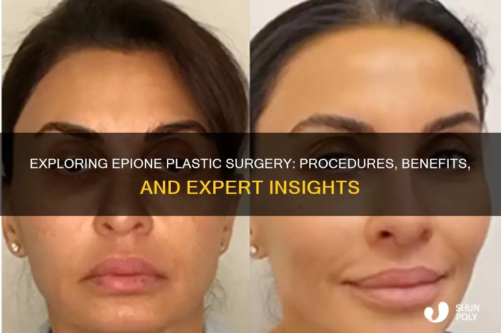 what is epione plastic surgery