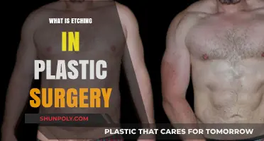 Understanding Etching: A Revolutionary Technique in Modern Plastic Surgery