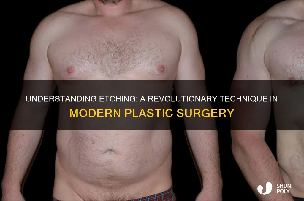 what is etching in plastic surgery