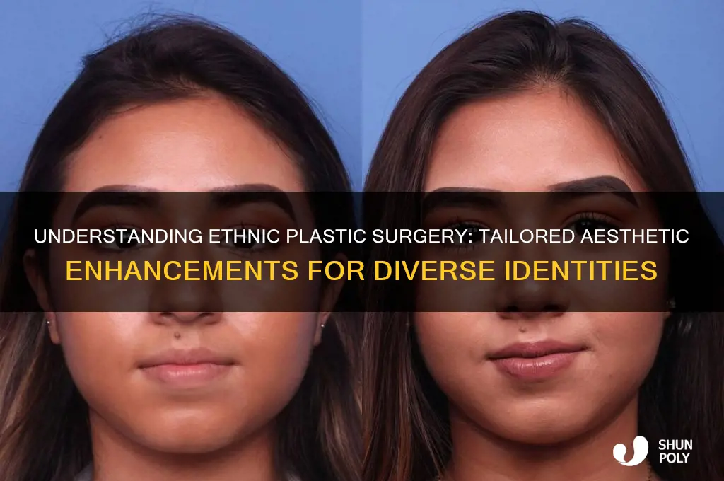 what is ethnic plastic surgery