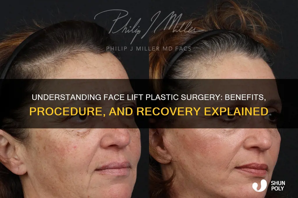 what is face lift plastic surgery