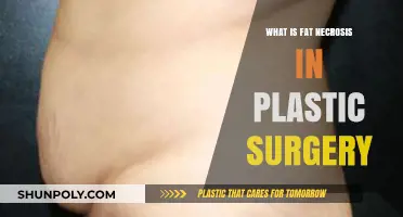 Understanding Fat Necrosis in Plastic Surgery: Causes, Symptoms, and Treatment