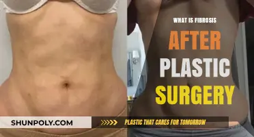 Understanding Fibrosis: Post-Plastic Surgery Scarring and Prevention Tips