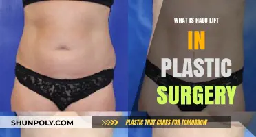 Understanding Halo Lift: A Revolutionary Technique in Modern Plastic Surgery