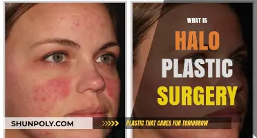 Understanding Halo Plastic Surgery: Benefits, Procedure, and Recovery Explained