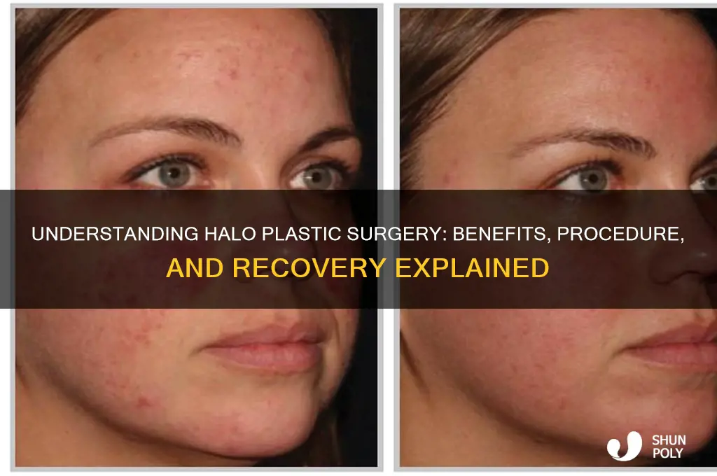 what is halo plastic surgery
