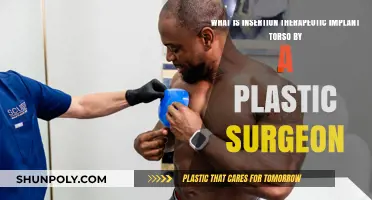 Understanding Insertion of Therapeutic Implants in the Torso by Plastic Surgeons