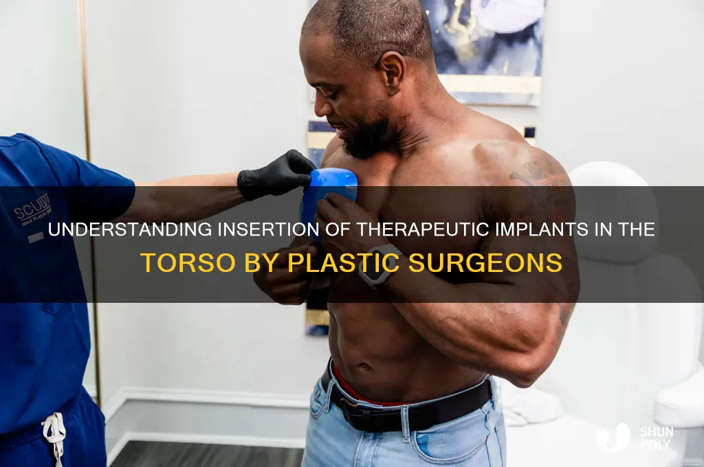 what is insertion therapeutic implant torso by a plastic surgeon