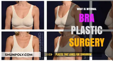 Understanding Internal Bra Plastic Surgery: Benefits, Procedure, and Recovery