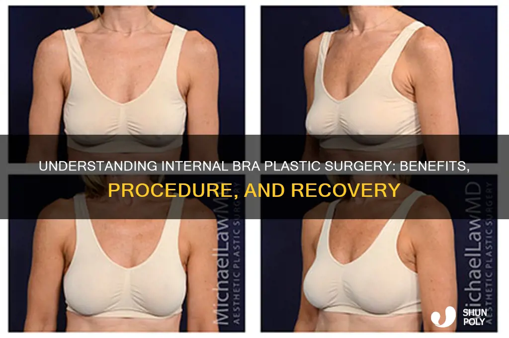 what is internal bra plastic surgery