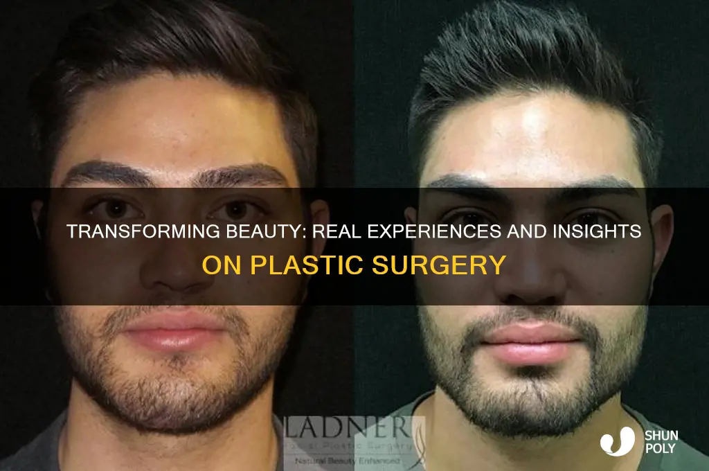 what is it like to get plastic surgery
