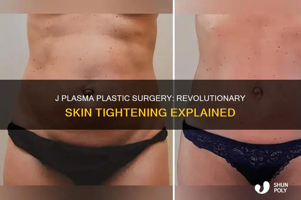 what is j plasma plastic surgery