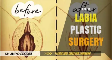 Understanding Labia Plastic Surgery: Procedure, Benefits, and Considerations