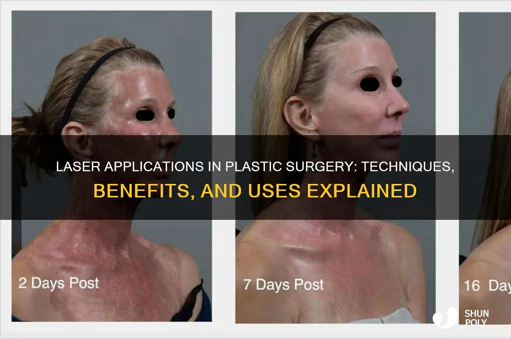 what is laser used for in plastic surgery