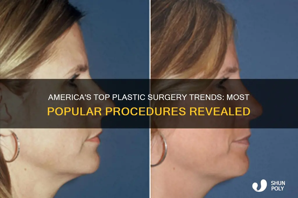 what is most common plastic surgery in america