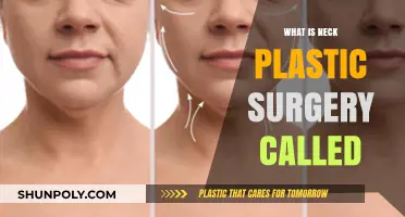 Understanding Neck Plastic Surgery: What is a Neck Lift Procedure?