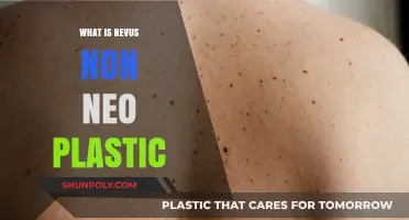 Understanding Nevus: Non-Neoplastic Skin Growths