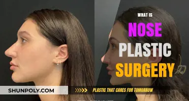 Understanding Rhinoplasty: What is Nose Plastic Surgery and Its Benefits
