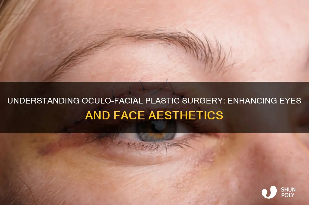 what is oculo facial plastic surgery