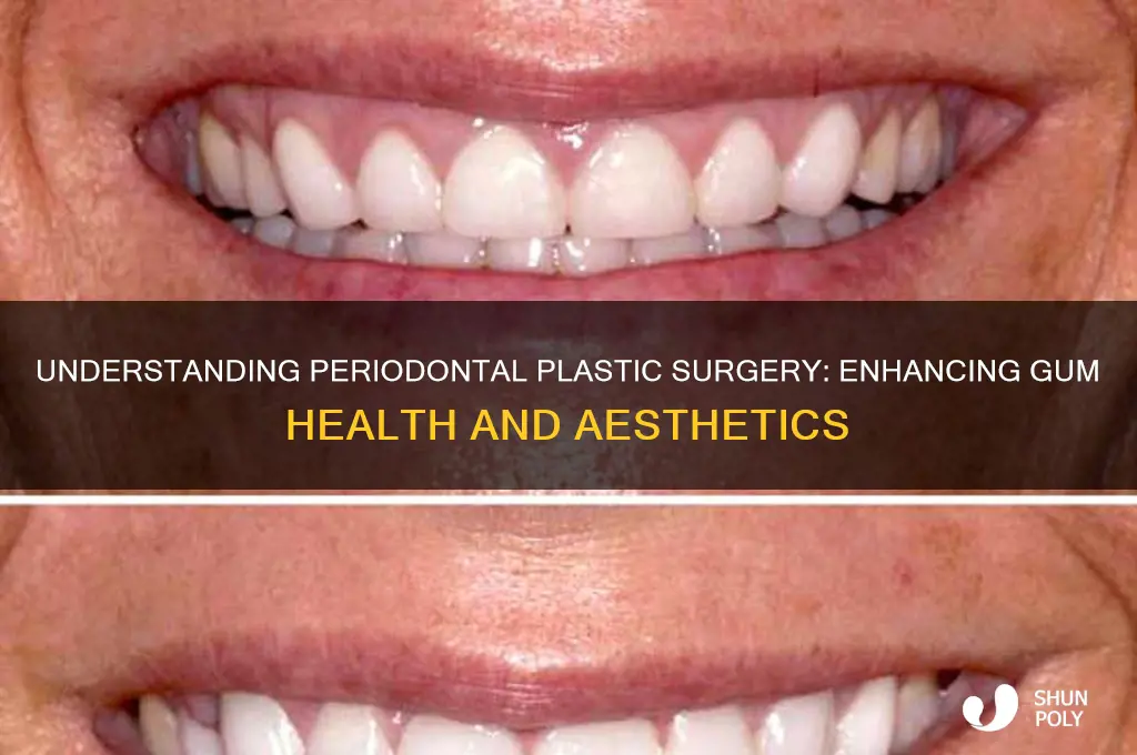what is periodontal plastic surgery