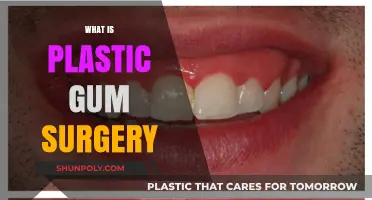 Understanding Plastic Gum Surgery: Benefits, Procedure, and Recovery Explained