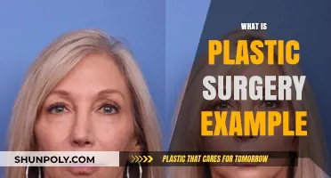 Understanding Plastic Surgery: Examples, Procedures, and Transformative Results