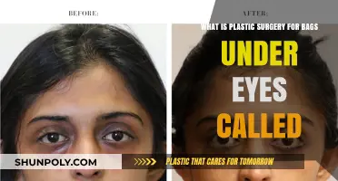 Say Goodbye to Under-Eye Bags: Discover Blepharoplasty Surgery