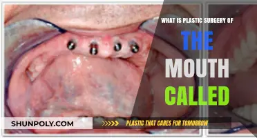 Understanding Oral Plastic Surgery: What is Mouth Reconstruction Called?