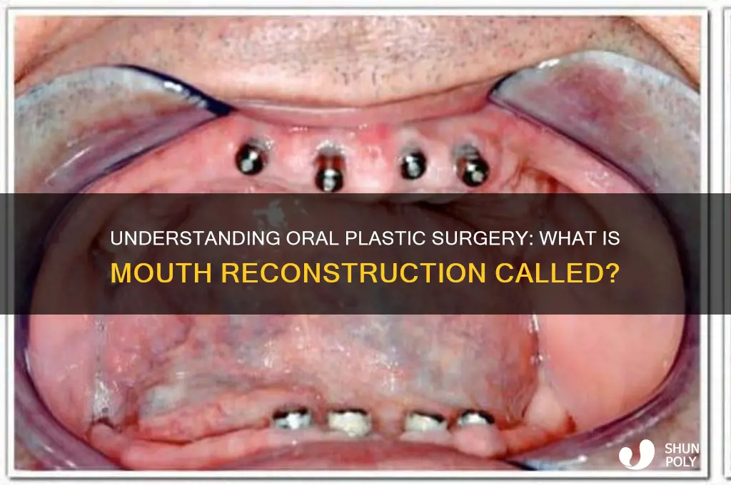 what is plastic surgery of the mouth called