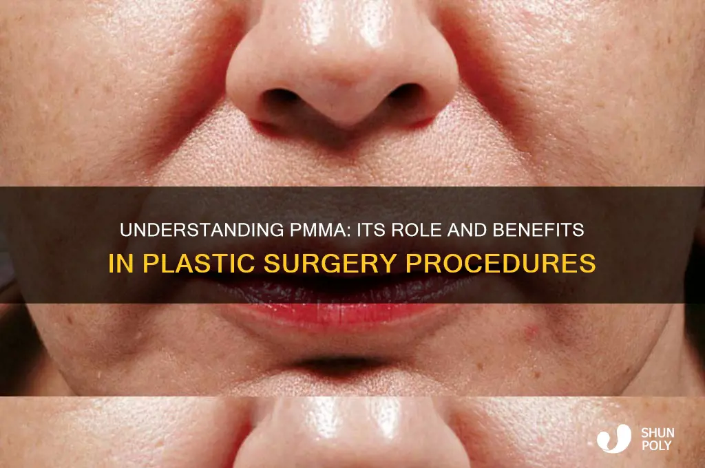 what is pmma in plastic surgery