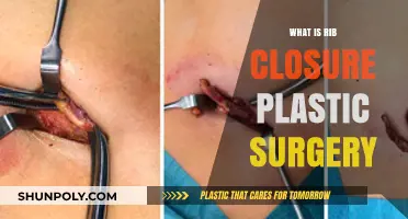 Understanding Rib Closure Plastic Surgery: Procedure, Benefits, and Recovery Explained
