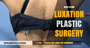 Understanding Rib Luxation Plastic Surgery: Causes, Procedures, and Recovery