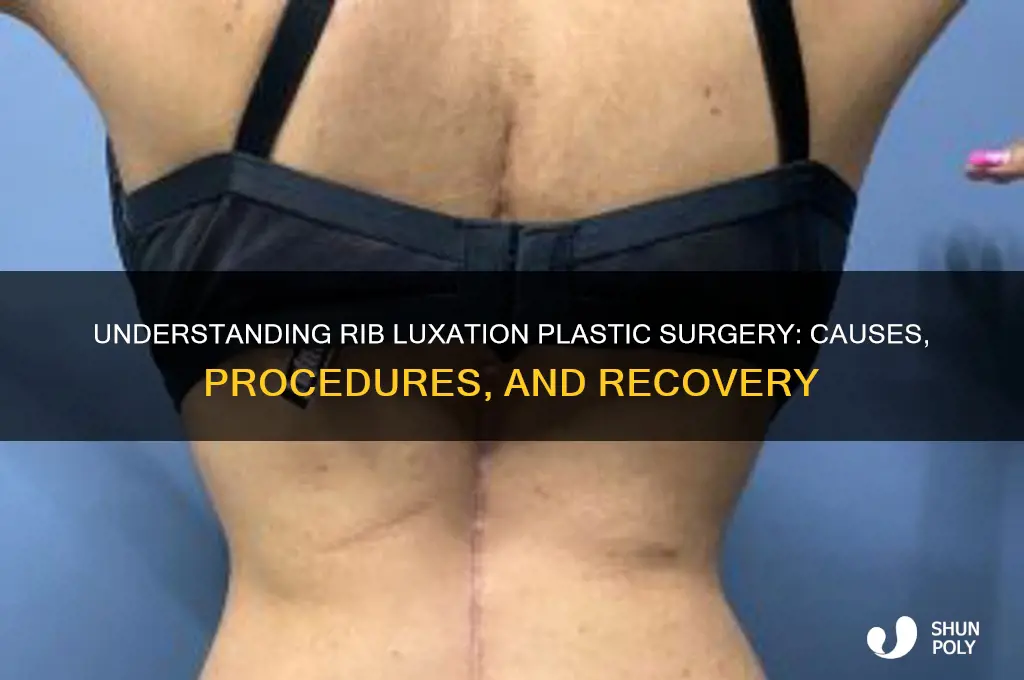what is rib luxation plastic surgery