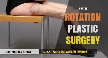 Understanding Rotation Plastic Surgery: Techniques, Benefits, and Recovery Process