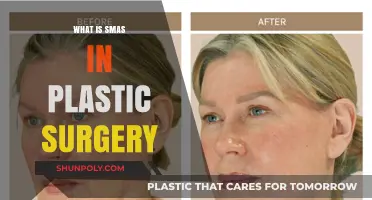 Understanding SMAS: A Key Technique in Facial Plastic Surgery