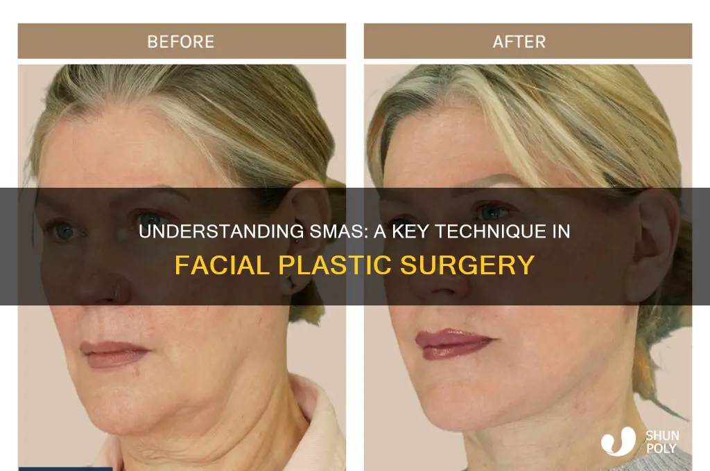 what is smas in plastic surgery