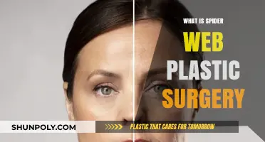 Spider Web Plastic Surgery: Revolutionary Technique for Lifting and Tightening Skin