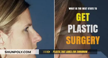 Top States for Plastic Surgery: Where to Get the Best Results