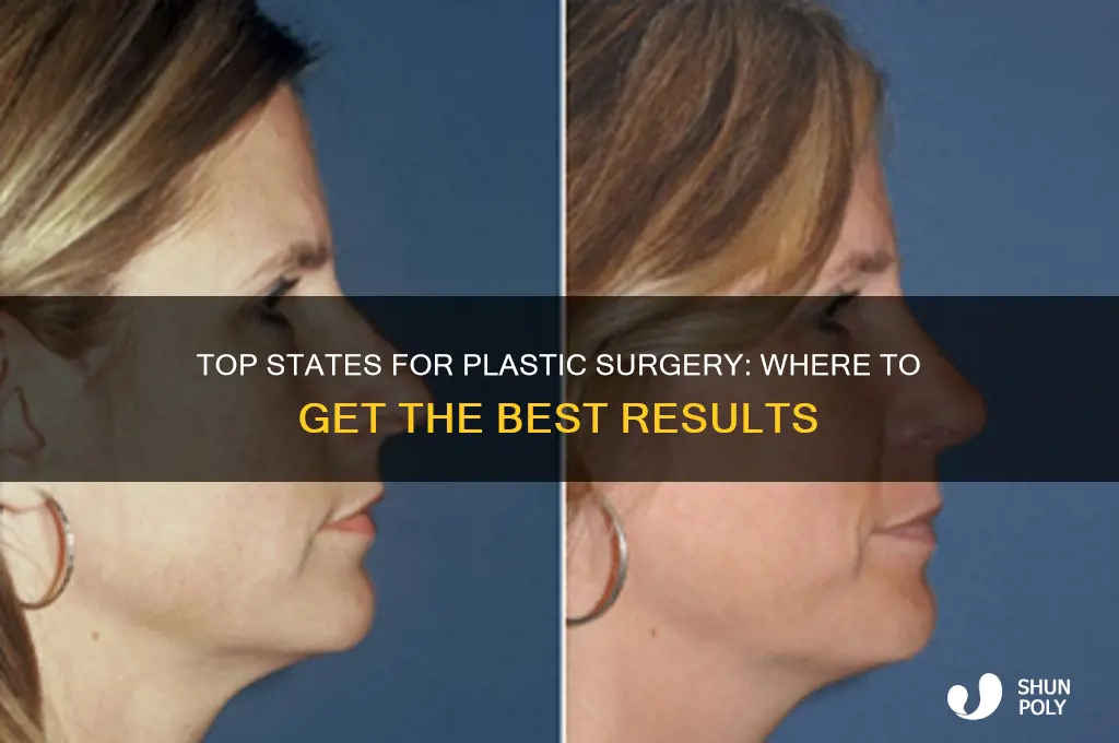 what is the best state to get plastic surgery