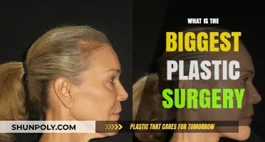 Exploring the Most Extensive Plastic Surgery Procedures and Transformations
