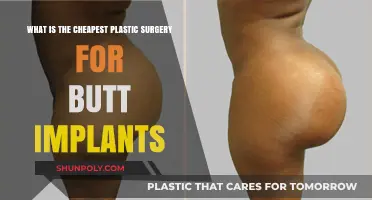 Affordable Butt Implants: Exploring the Cheapest Plastic Surgery Options